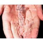 Kaip biure neužsikrėsti gripu