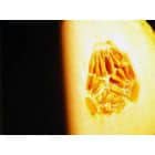 Kuo naudingas melionas?