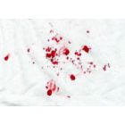 Jei dažnai kraujuoja iš nosies