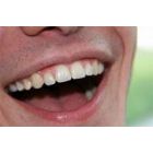 Mitai apie dantų priežiūrą