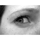 Kaip greitai ir visam laikui atsikratyti strazdanų?