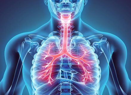 Įsitikinkite, ar nesergate sunkia ir klastinga lėtine obstrukcine plaučių liga