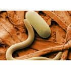 Mikroskopinės scenos stambiu planu, kuriame matyti apvalus, į piliulę panašus objektas ir ilga, lenkta struktūra ant tekstūruoto oranžinės rudos spalvos paviršiaus. Šis vaizdas greičiausiai vaizduoja Trichinella, išryškindamas parazitų infekcijos aspektus, pastebėtus padidinus.