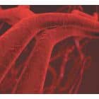 Zofenoprilis: nauji faktai apie poveikį aterosklerozei