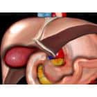 Išsami 3D iliustracija žmogaus pilvo organų, įskaitant kepenis, tulžies pūslę, paveiktą cholecistito, skrandį ir žarnas. Organai vaizduojami įvairiomis spalvomis, siekiant išryškinti jų struktūras tamsiame fone. - Pasveik.lt Išsami 3D iliustracija žmogaus pilvo organų, įskaitant kepenis, tulžies pūslę, paveiktą cholecistito, skrandį ir žarnas. Organai vaizduojami įvairiomis spalvomis, siekiant išryškinti jų struktūras tamsiame fone.
