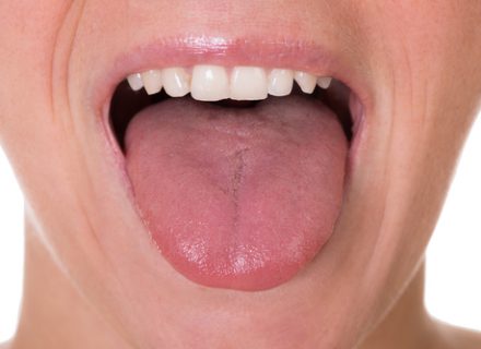 Apžiūrėk liežuvį – diagnozuok ligą