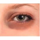 Paakių odos priežiūra