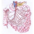 Žmogaus virškinimo sistemos iliustracija, daugiausia dėmesio skiriant plonosios žarnos. Diagramoje parodytas plonųjų ir storųjų žarnų išsidėstymas su detaliomis kraujagyslių struktūromis ir išryškintos tokios problemos kaip žarnų nepraeinamumas, apimantis kasą. - Pasveik.lt Žmogaus virškinimo sistemos iliustracija, daugiausia dėmesio skiriant plonosios žarnos. Diagramoje parodytas plonųjų ir storųjų žarnų išsidėstymas su detaliomis kraujagyslių struktūromis ir išryškintos tokios problemos kaip žarnų nepraeinamumas, apimantis kasą.