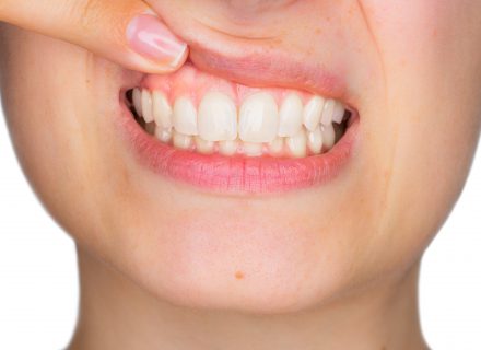 6 netikėtos priežastys rūpintis savo dantenomis