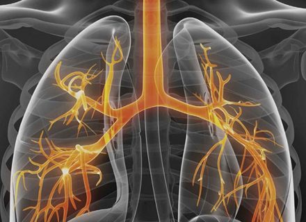 Lėtinė obstrukcinė plaučių liga – ką apie ją žinote?