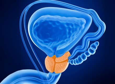 5 prostatai naudingos maistinės medžiagos