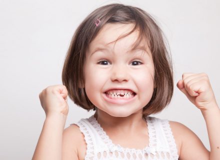 3 klausimai apie pieninius dantis
