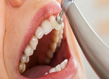 Kas kiek laiko būtina atlikti profilaktinę dantų apžiūrą?