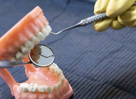 Kaip išsirinkti dantų protezus Kaune?