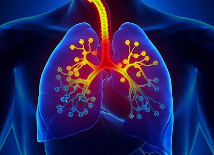 <strong>Koks naujas gydymo būdas gali padėti sukontroliuoti sunkią astmą?</strong>