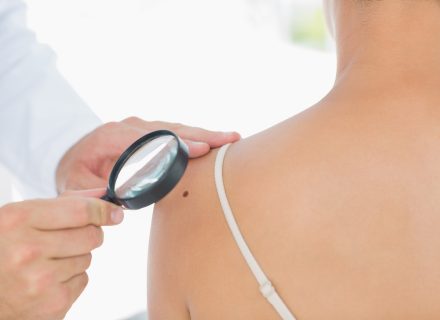 <strong>Progresavusi melanoma: ar visus ligonius pasiekia modernūs vaistai?</strong>