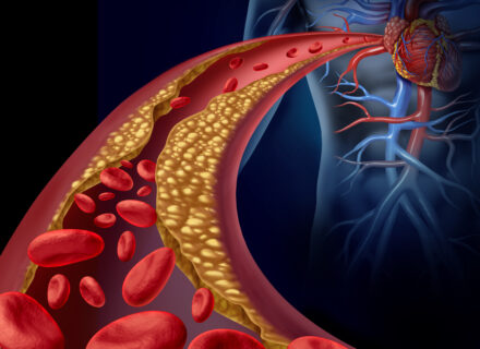 Antitrombozinių vaistų skyrimas po kraujavimo iš virškinimo trakto