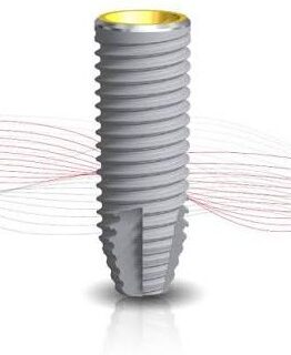 Dantų implantacijos kaina Vilniuje: kas sudaro galutinę gydymo kainą?